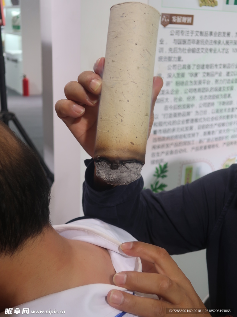 Moxibustion heat therapy treatment in a clinical setting